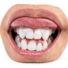 Richmond Dental Cotton Rolls 100 Cotton Medical Grade-2
